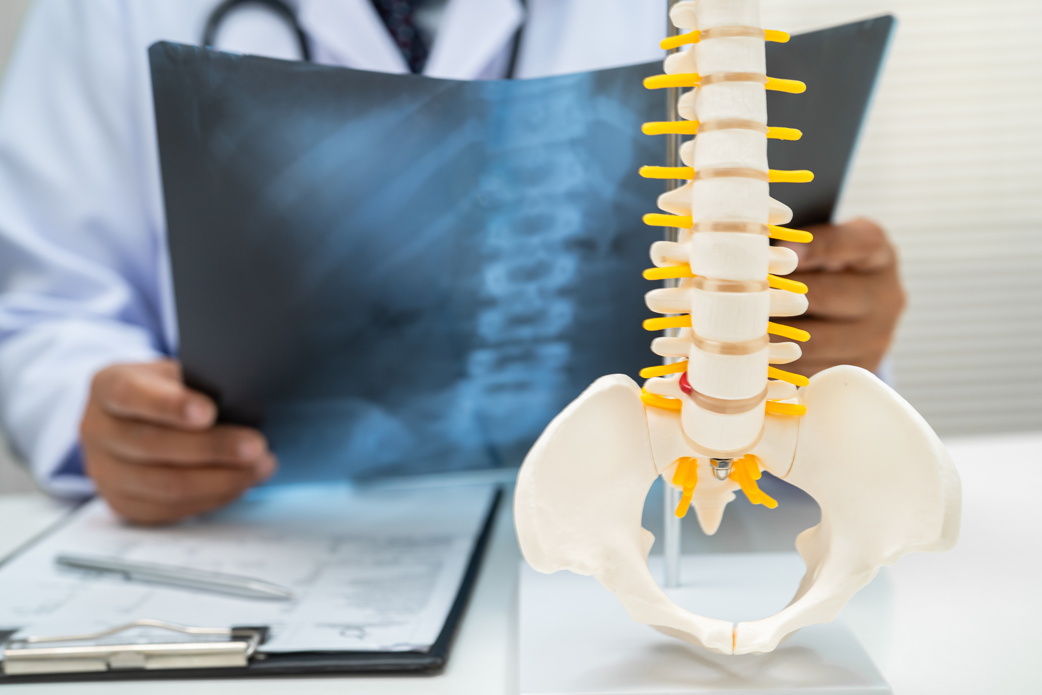 spinal cord stimulation for chronic pain