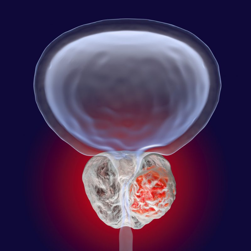 Prostate Vector